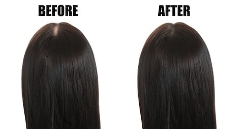 Before - After